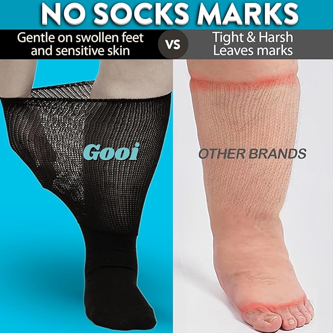 Extra Wide Diabetic Socks for Swollen Feet Men Women Non Binding Soft Stretch Colorful Design